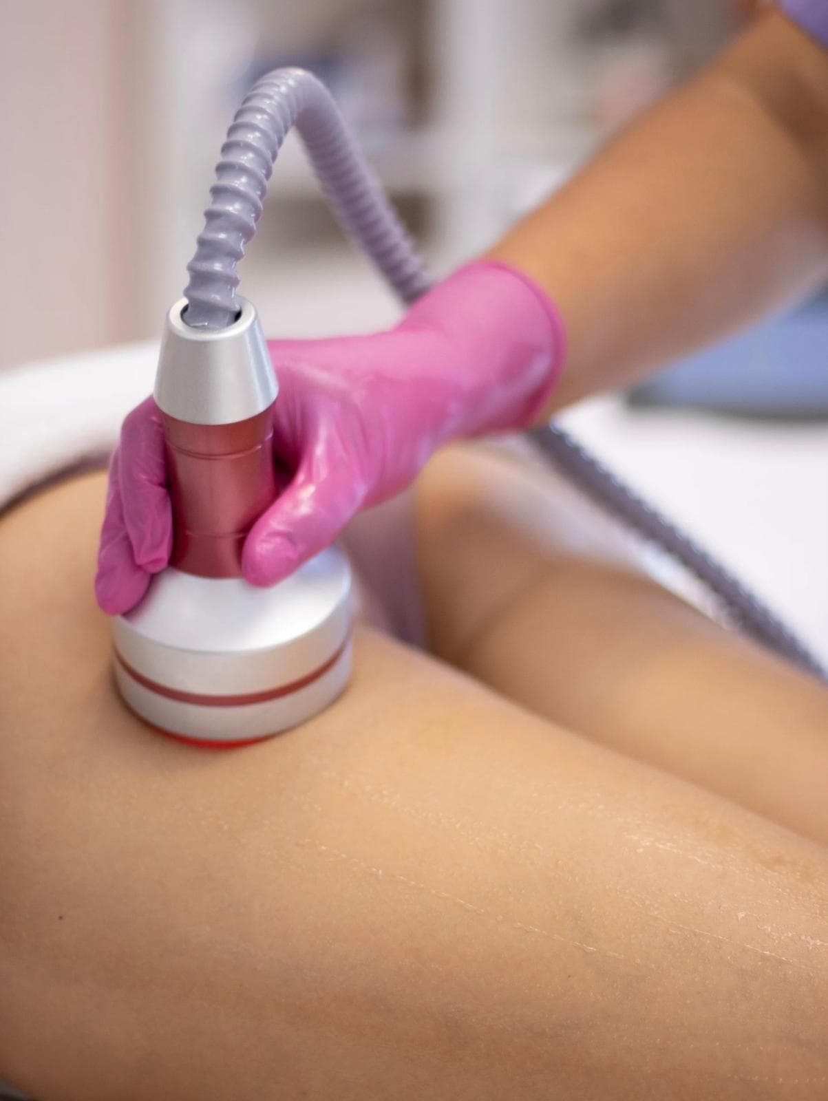 Cavitation + RF